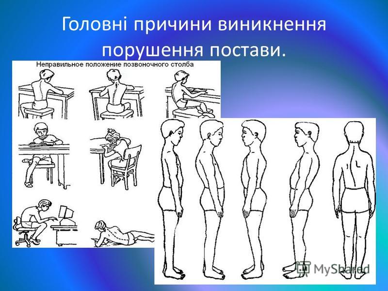 Порушення постави у дошкільнят. Порушення постави у дітей: причини, симптоми, діагностика, лікування Презентация на тему: "Типи порушення постави. Сколіоз. ВИКОНАЛА. Лікування порушення постави у дітей. Центр «Стаміна» у Києві