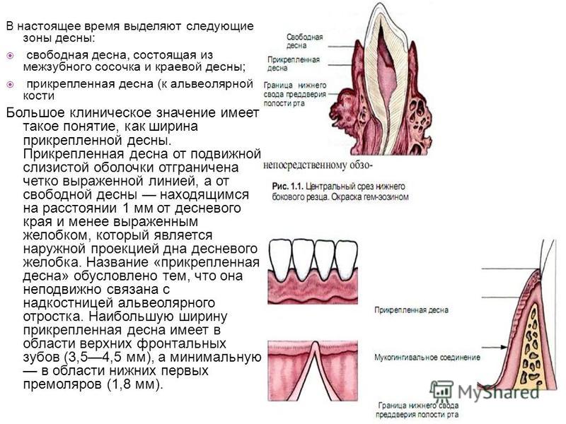 Которая десну не вяжет Которая десну не вяжет