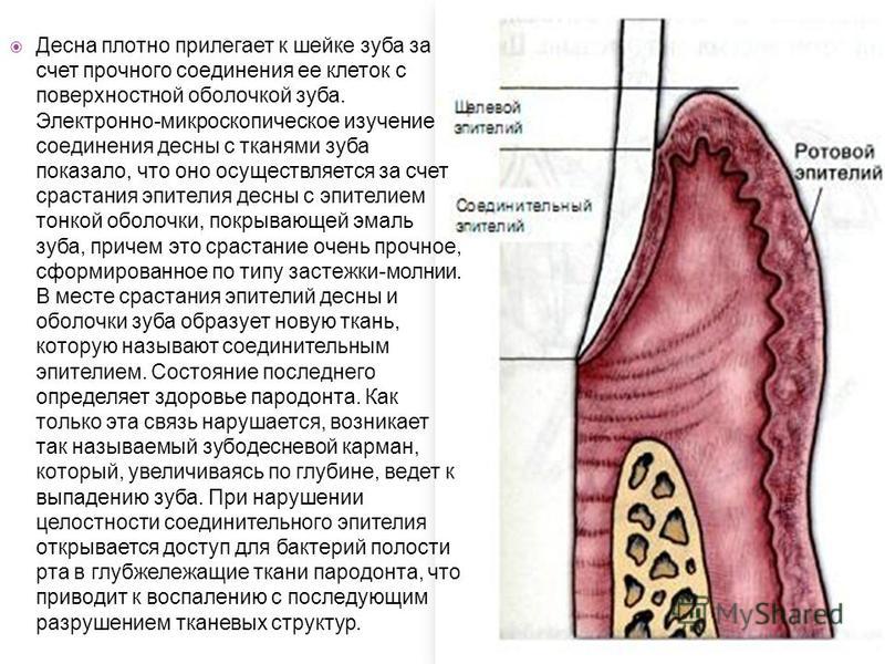 На игле (фильм) Викицитатник Гранулятор своими руками Изготовление пеллет своими руками