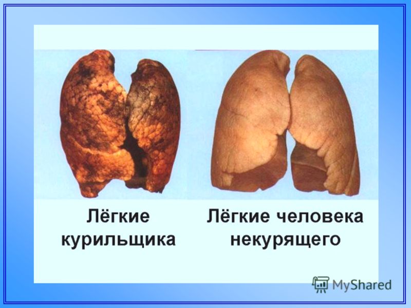 Руны для увеличения потенции мировоззрению руны для увеличения потенции