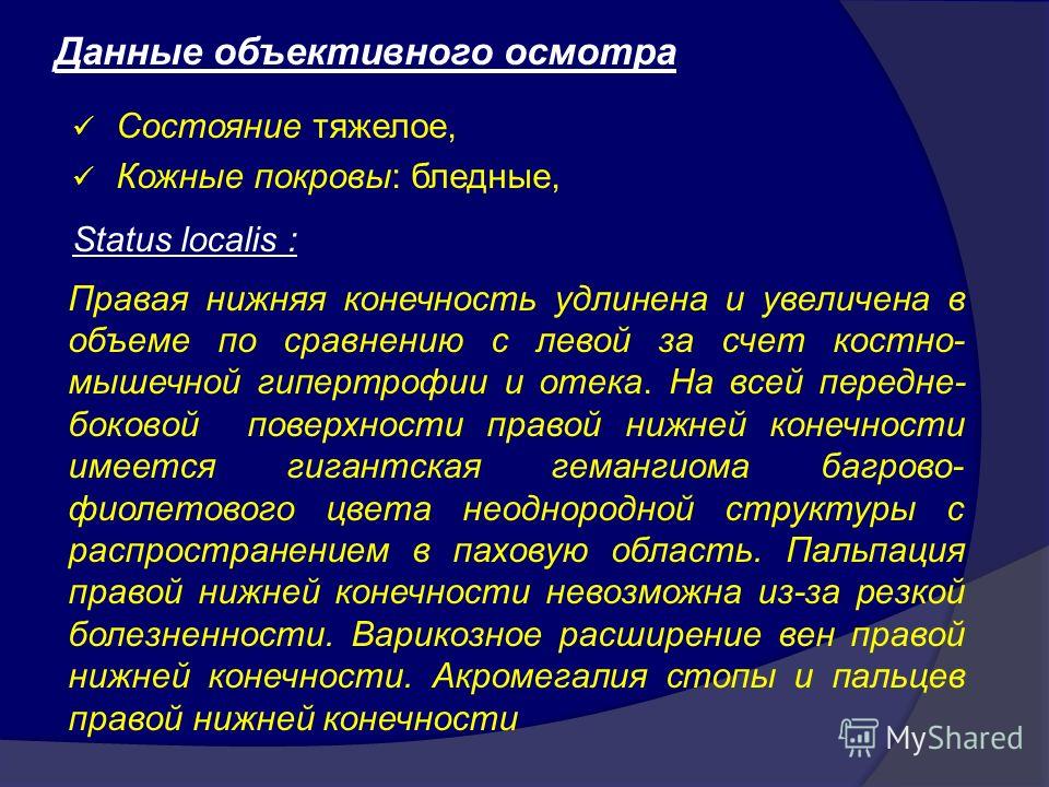 Причины варикоза вен на ногах