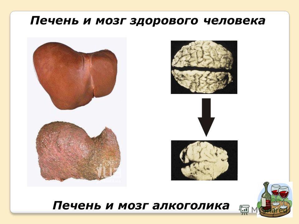 Скачать Презентация на Тему Закаливание Организма