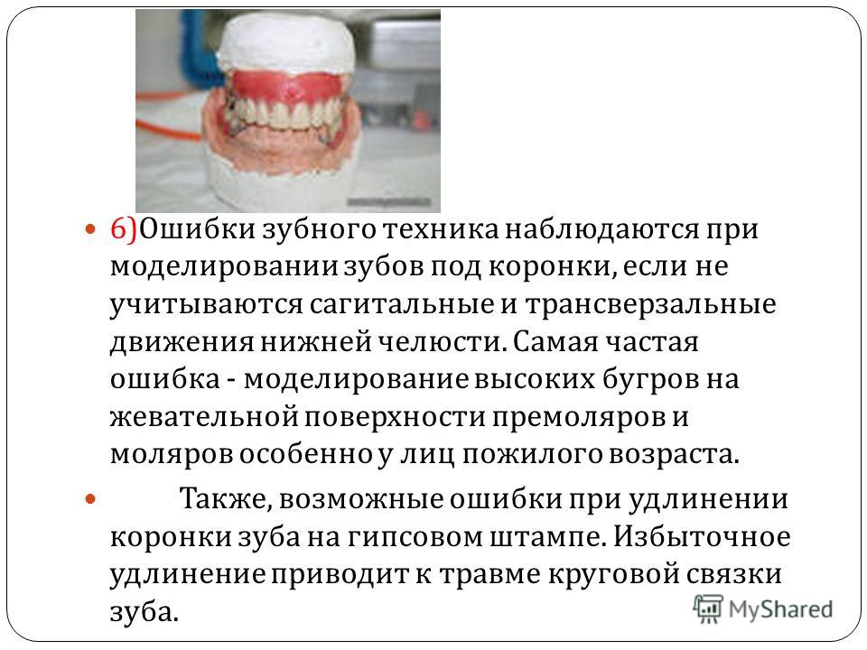 Моделирование жевательной поверхности зуба Моделирование жевательной поверхности зуба