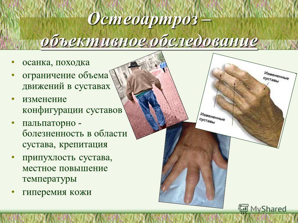 Лфк при артрите рук Лфк при артрите рук