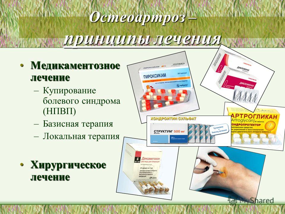 Рентгенодиагностика плечевого сустава Рентгенодиагностика плечевого сустава