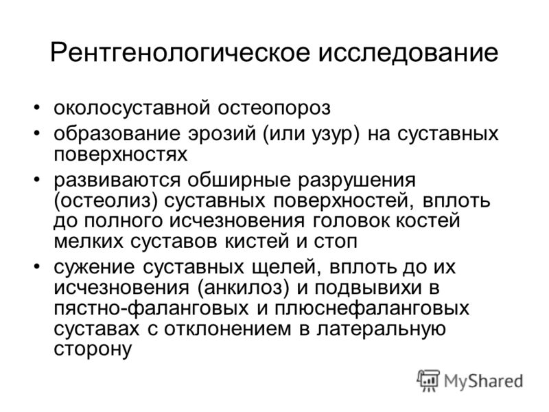 Утренняя скованность суставов стоп Утренняя скованность суставов стоп