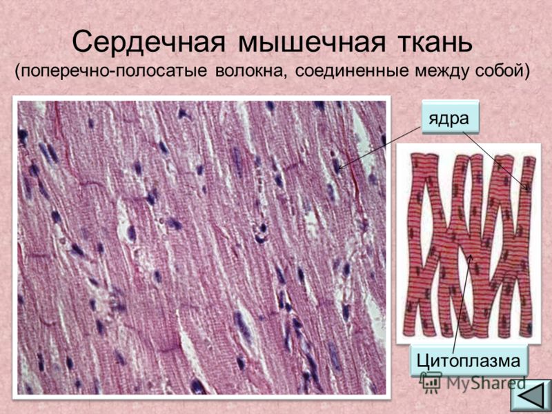 Сердечная мышечная ткань (поперечно-полосатые волокна, соединенные между собой) ядра Цитоплазма