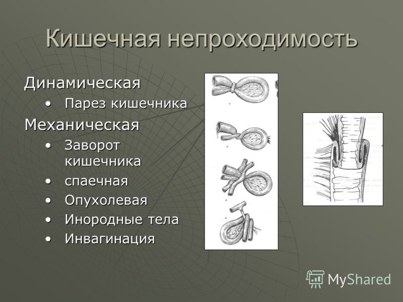 Диета После Заворота Кишок