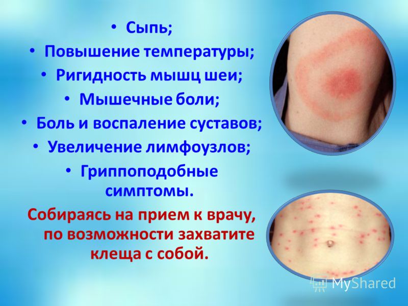 Температура и чешущаяся сыпь Температура и чешущаяся сыпь