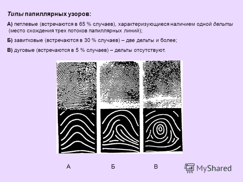 Общие и частные признаки папиллярных узоров Общие и частные признаки папиллярных узоров