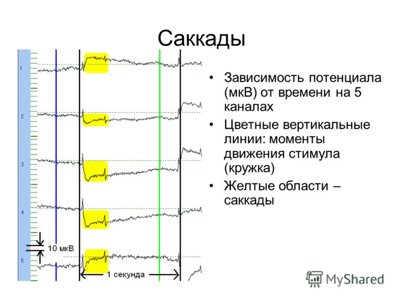 Саккады Зависимость потенциала (мкВ) от времени на 5 каналах Цветные вертикальные линии: моменты движения стимула (кружка) Желтые области – саккады