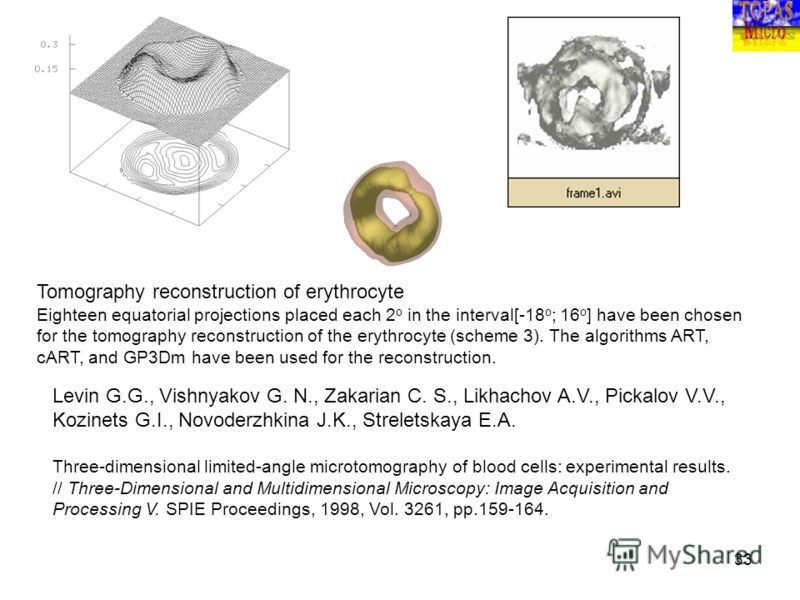 33 Tomography reconstruction of erythrocyte Eighteen equatorial projections placed each 2 o in the interval[-18 o ; 16 o ] have been chosen for the tomography reconstruction of the erythrocyte (scheme 3). The algorithms ART, cART, and GP3Dm have been