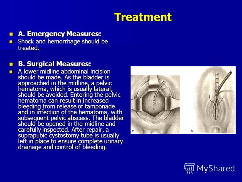 Treatment A. Emergency Measures: A. Emergency Measures: Shock and hemorrhage should be treated. Shock and hemorrhage should be treated. B. Surgical Measures: B. Surgical Measures: A lower midline abdominal incision should be made. As the bladder is a