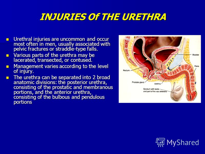 INJURIES Of THE URETHRA Urethral injuries are uncommon and occur most often in men, usually associated with pelvic fractures or straddle-type falls. Urethral injuries are uncommon and occur most often in men, usually associated with pelvic fractures 