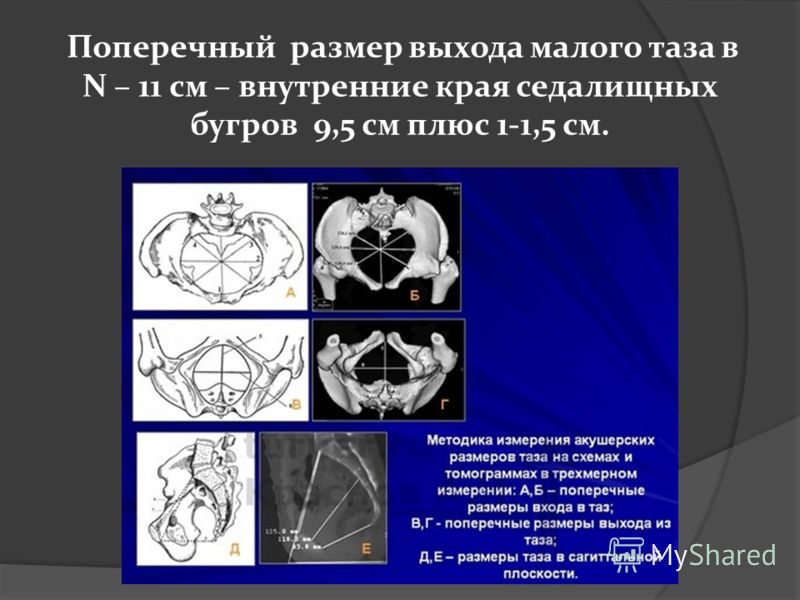 поперечный размер малого таха поперечный размер малого таха