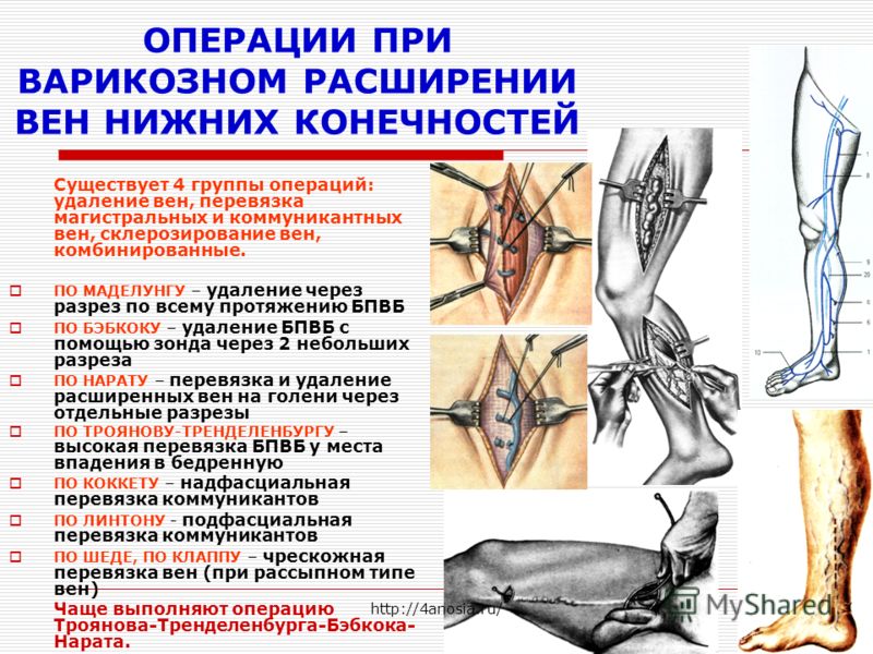 Лечение варикоза алмагом отзывы