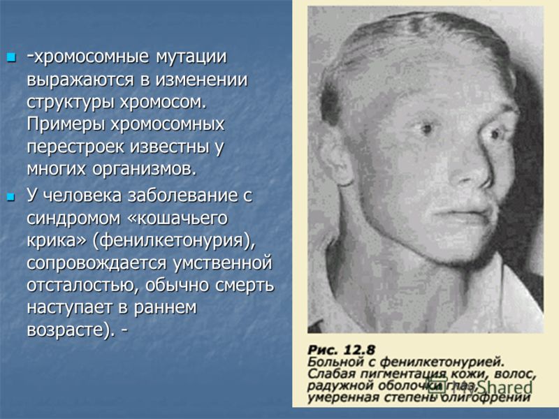 Заболевания связанные с хромосомными мутациями у человека Заболевания связанные с хромосомными мутациями у человека