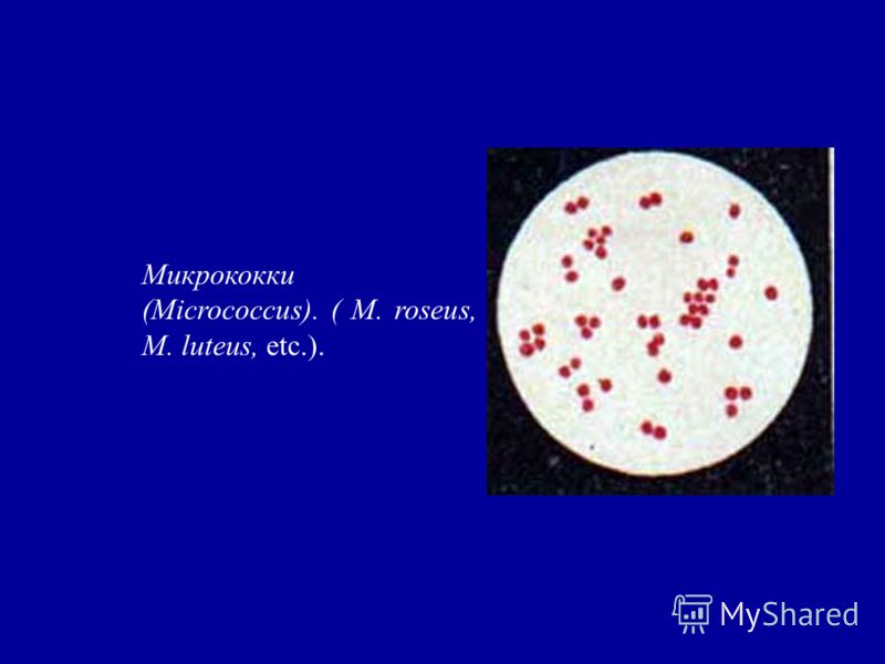 identifying micrococcus luteus essay I need help identifying an unknown it's probably micrococcus luteusthe then you can start to narrow down what tests will give the most info on identifying. identifying micrococcus luteus essay I need help identifying an unknown it's probably micrococcus luteusthe then you can start to narrow down what tests will give the most info on identifying.