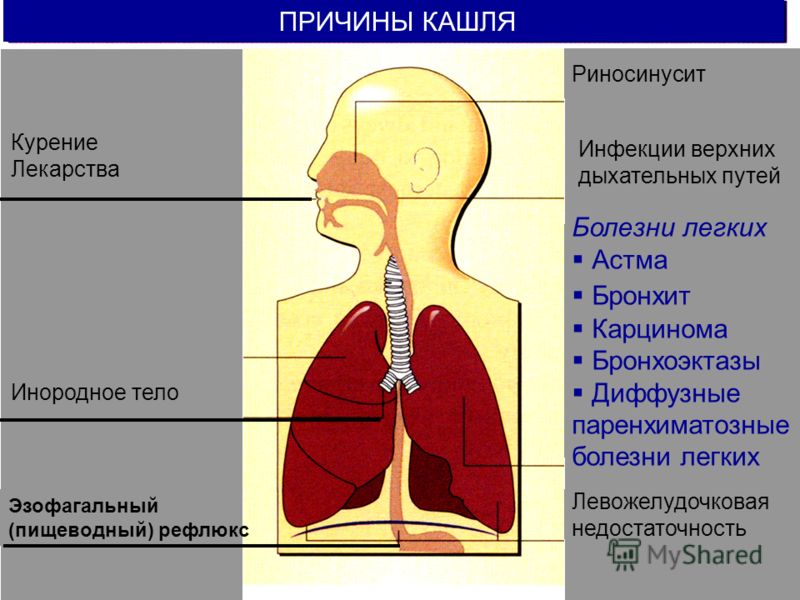 Как лечить верхние дыхательные пути лекарствами Как лечить верхние дыхательные пути лекарствами