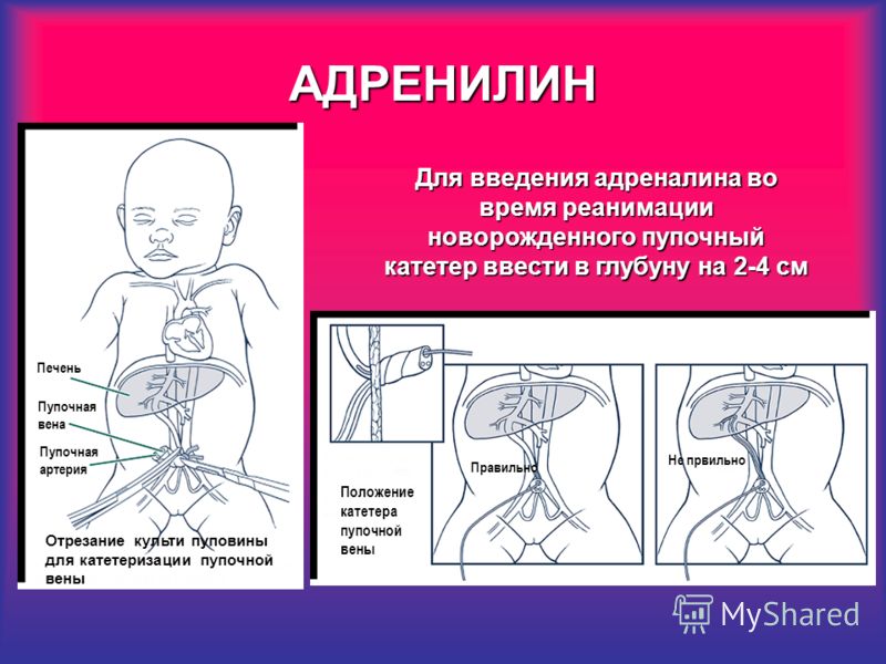 Лечение от варикоза на ногах в домашних условиях