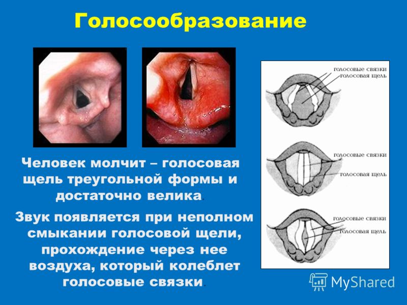 Лечить голосовые связки в домашних условиях 234
