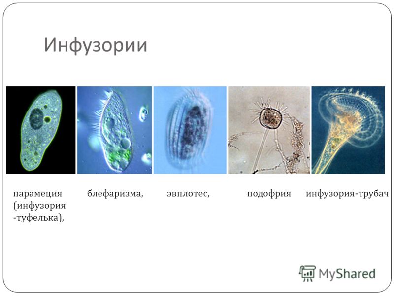 Инфузория это бактерия Инфузория это бактерия