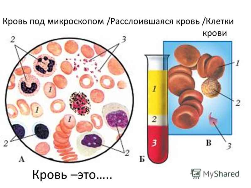 Кровь Под Микроскопом Фото