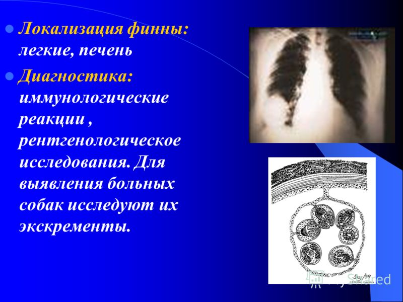 пижма паразитов организме человека пижма паразитов организме человека