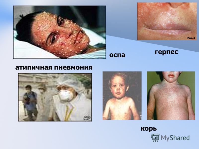 Боль в правой нижней части живота у девочек