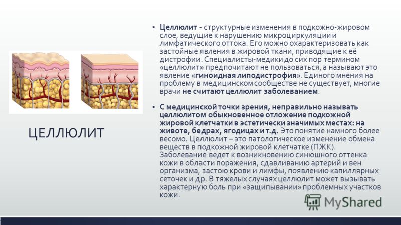 В подкожно жировом слоев кожи что это В подкожно жировом слоев кожи что это