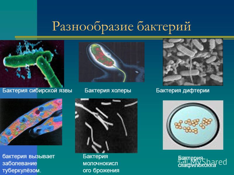 Разнообразие бактерий Бактерия сибирской язвы бактерия вызывает заболевание туберкулёзом. Бактерия холеры Бактерия молочнокисл ого брожения Бактерия дифтерии Бактерия стафилококка
