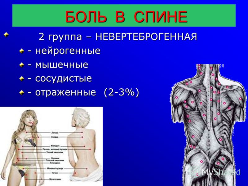 Став от боли в пояснице Став от боли в пояснице