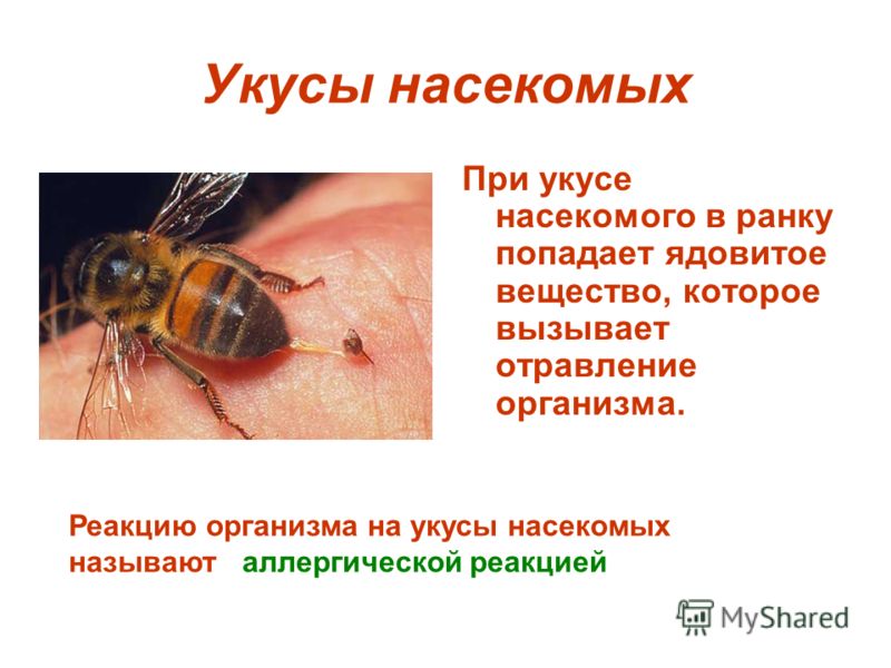 Реферат на тему укусы ядовитых змей и насекомых 5525