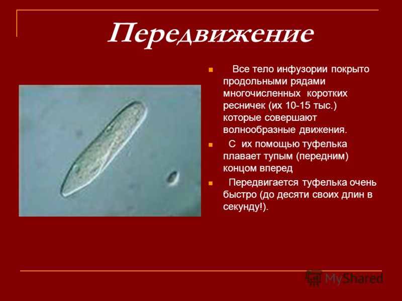 Инфузория туфелька передвигается при помощи ресничек Инфузория туфелька передвигается при помощи ресничек