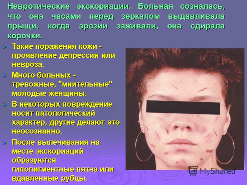 прыщи от паразитов прыщи от паразитов
