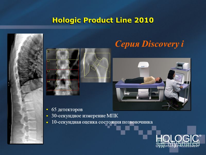 Hologic Product Line 2010 65 детекторов 30-секундное измерение МПК 10-секундная оценка состояния позвоночника Серия Discovery i