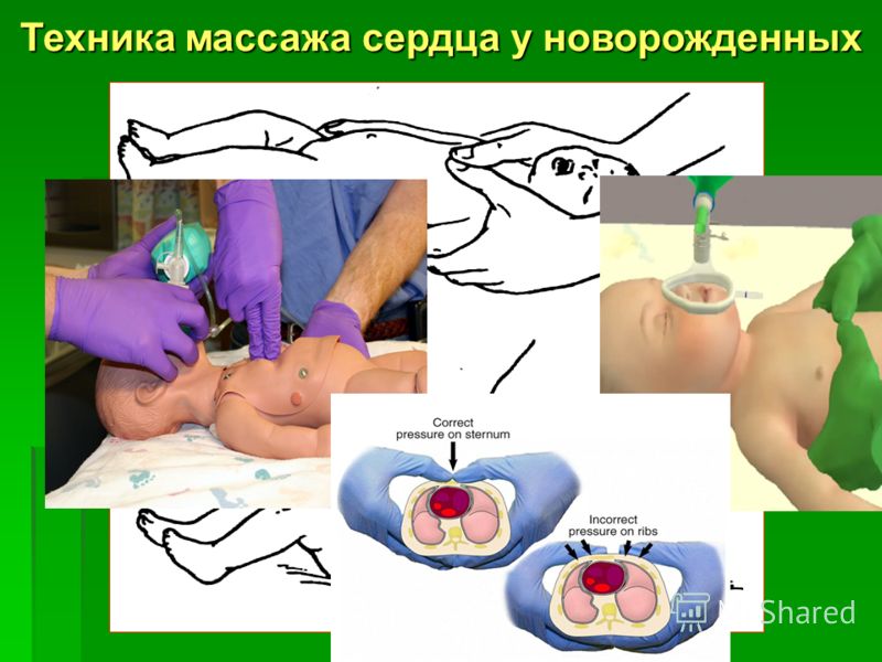 Все алгоритмы массажа Все алгоритмы массажа