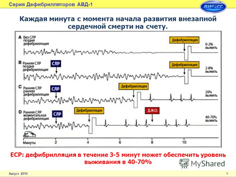 Звук разряда дефибриллятора скачать