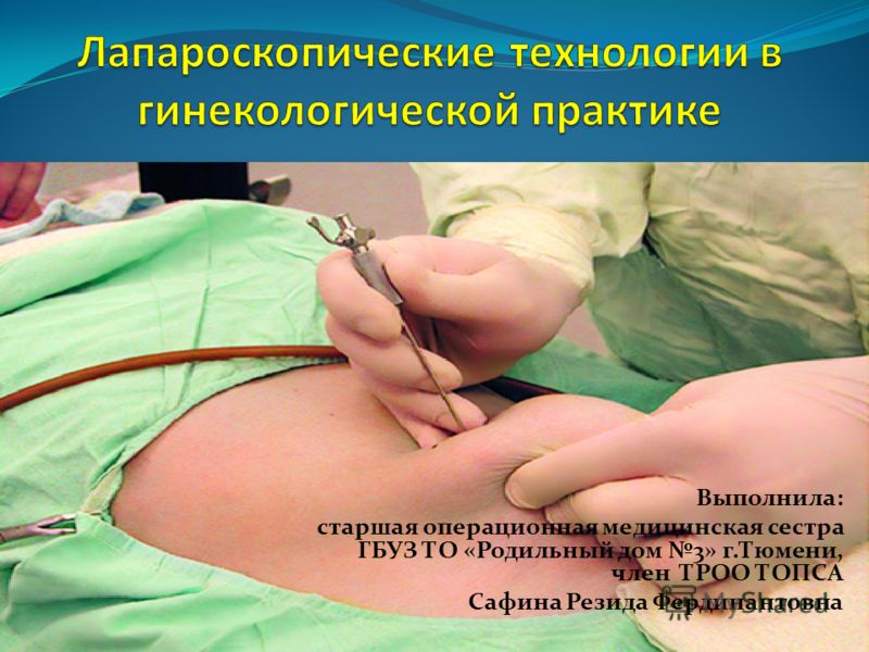Контрольная работа по теме Лапароскопия в гинекологии