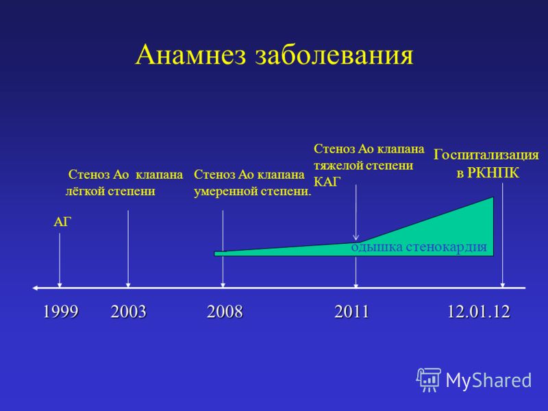 Реферат: История болезни - ИБС