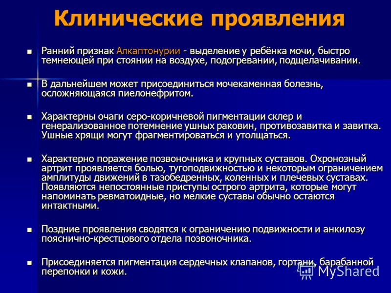 Нарушение обмена серосодержащих аминокислот (гомоцистинурия) у детей