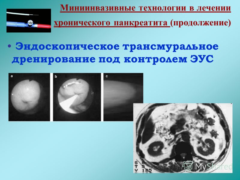 Народные средства лечение эстрогена женских гормонов