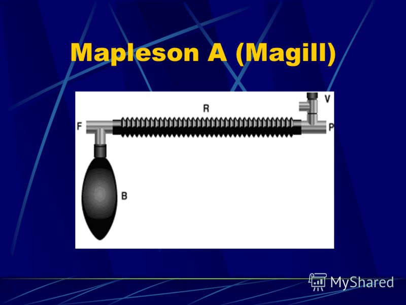 Mapleson A (Magill)