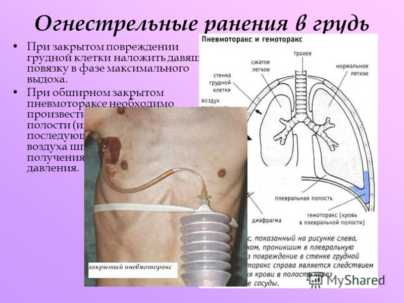 Практическое задание по теме Проникающее колото-резаное ранение грудной клетки 