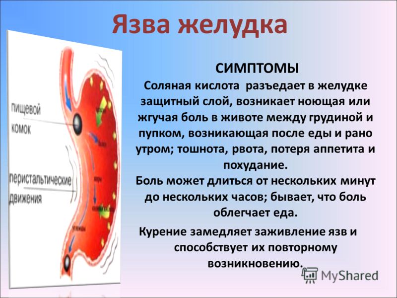 Все что связано с болями в желудке и спине Все что связано с болями в желудке