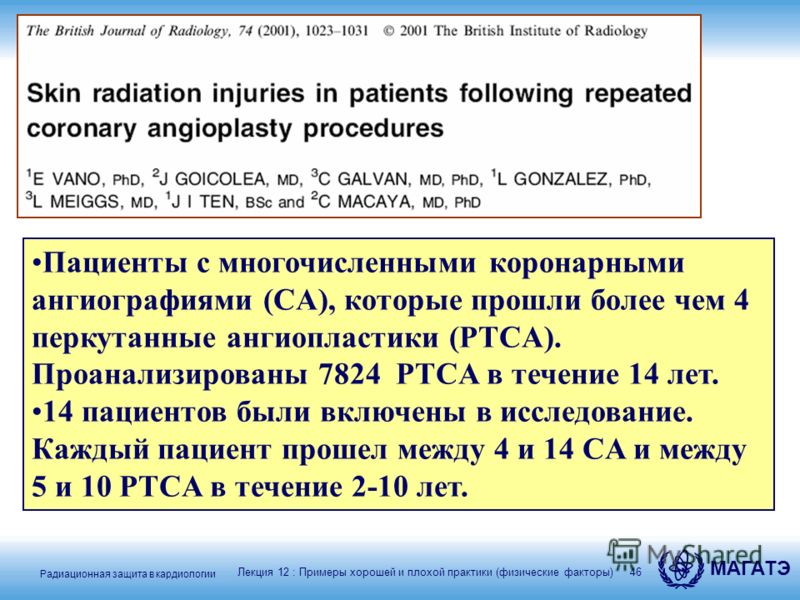 Радиационная защита в кардиологии МАГАТЭ 46 Пациенты с многочисленными коронарными ангиографиями (CA), которые прошли более чем 4 перкутанные ангиопластики (PTCA). Проанализированы 7824 PTCA в течение 14 лет. 14 пациентов были включены в исследование