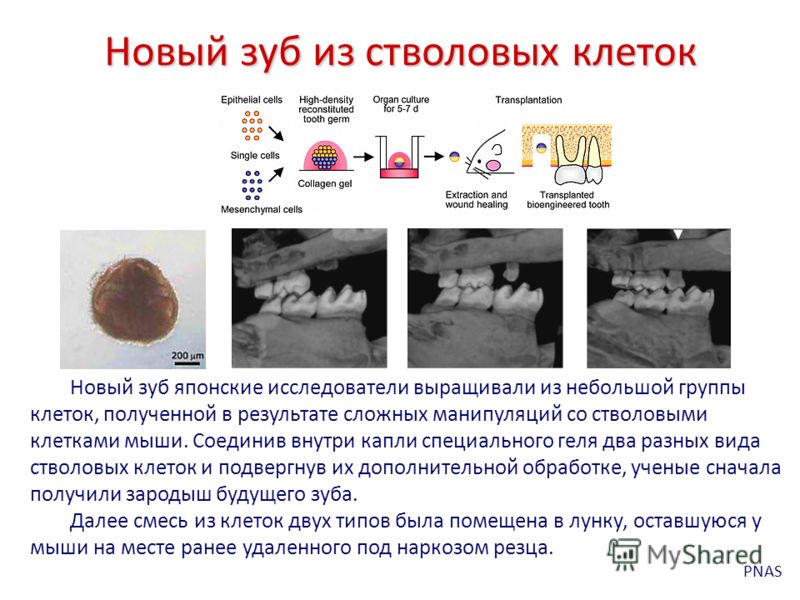 Как вылечить ячмень на глазу быстро 95 Как вылечить ячмень на глазу быстро 11