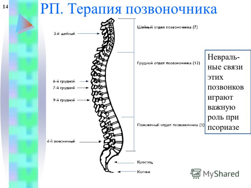 Позвоночника и псориаз Позвоночника и псориаз
