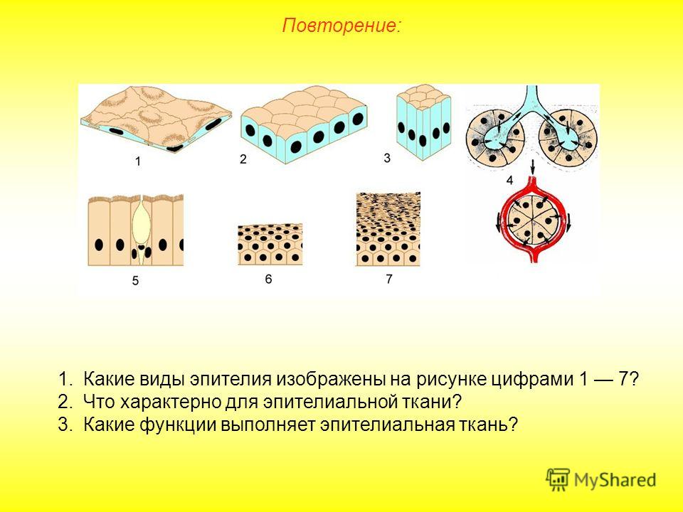 Какие виды узоров существуют Какие виды узоров существуют