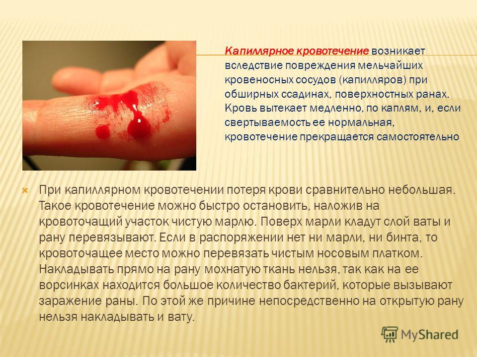 Почему во время беременности идет кровь Почему во время беременности идет кровь